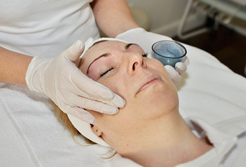 Peeling chemiczny / Peelingi chemiczne